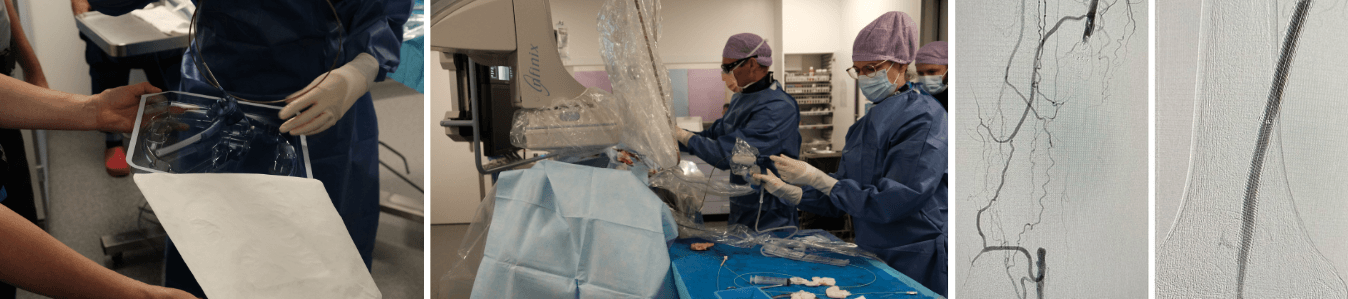 1E Patient Rotarex Afbeelding Banner Website 1348X299 7